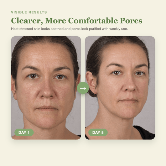 Olivine Cactox De Puffing Pore Tox Gel Mask Day 1 to Day 8 visible results