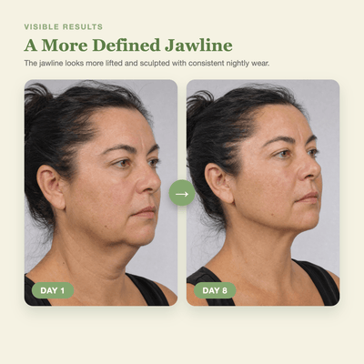 Olivine Cactox V Lifting Mewing Band Day 1 to Day 8 visible results
