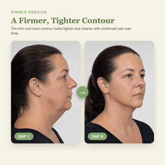 Olivine Cactox V Lifting Mewing Band Day 1 to Day 8 visible results