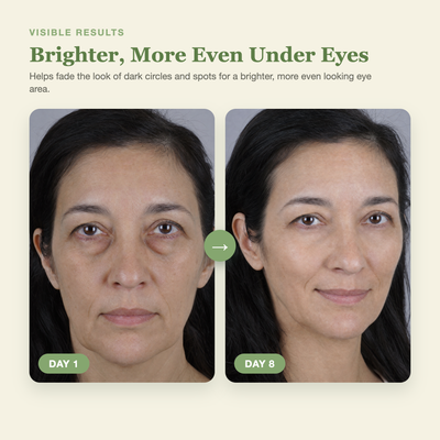 Olivine Calcium Dark Spot Eye Cream Day 1 to Day 8 visible results