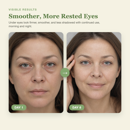 Olivine Calcium Dark Spot Eye Cream Day 1 to Day 8 visible results