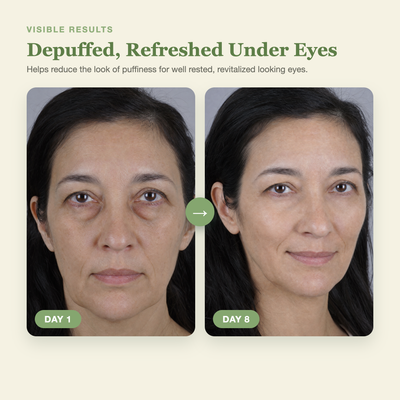 Olivine Calcium Volume Eye Patch Day 1 to Day 8 visible results