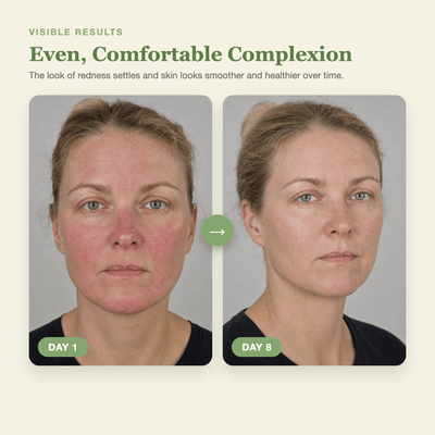 Olivine Matcha Dual PDRN Serum Day 1 to Day 8 visible results