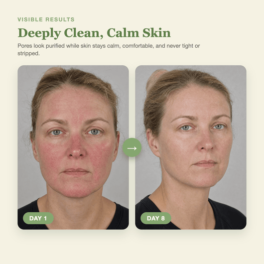 Olivine Matcha Pack Cleanser Day 1 to Day 8 visible results