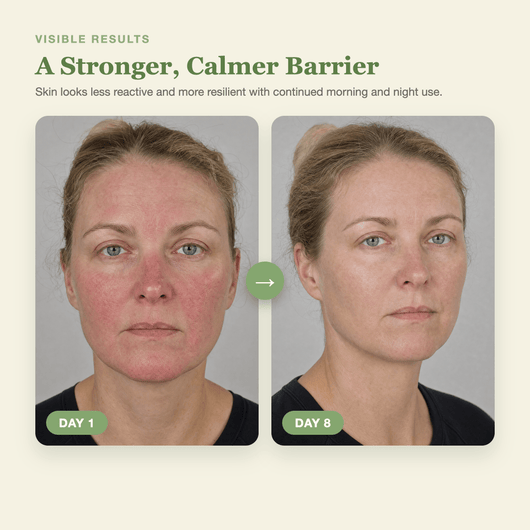Olivine Matcha PDRN Calming Cream Day 1 to Day 8 visible results