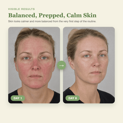 Olivine Matcha PDRN Skin Toner Day 1 to Day 8 visible results