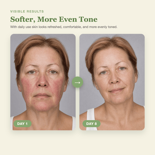 Olivine Matcha PDRN Skin Toner Day 1 to Day 8 visible results