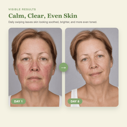 Olivine Matcha PDRN Tea Pad Day 1 to Day 8 visible results