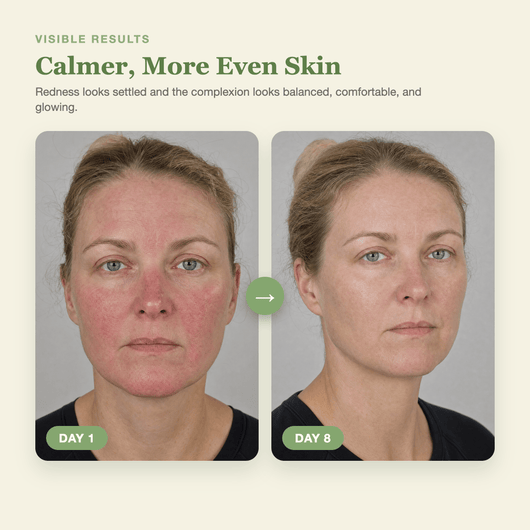 Olivine Matcha Toner and Cream Duo Day 1 to Day 8 visible results