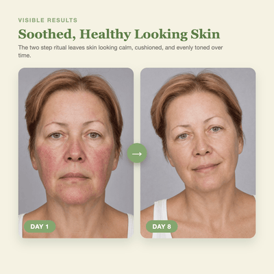 Olivine Matcha Toner and Cream Duo Day 1 to Day 8 visible results