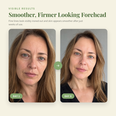 Silk Peptide EGF Toner, Smoothing Peptide Toner for Fine Lines — results-1